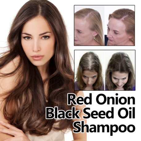 Eelhoe Red Onion And Black Seed Oil Hair Care Essential Oil, Nourishing And Nourishing Hair, Smoothing And Repairing Dry Hair - Image 4