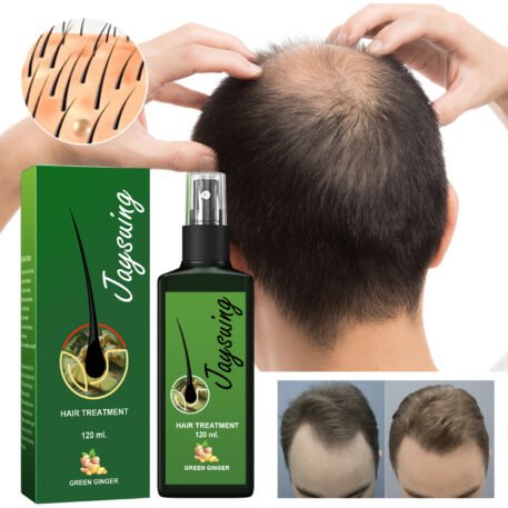 Hair Care Solution Gently Nourishes And Massages Scalp, Moisturizes And Softens Hair Care Spray - Image 3